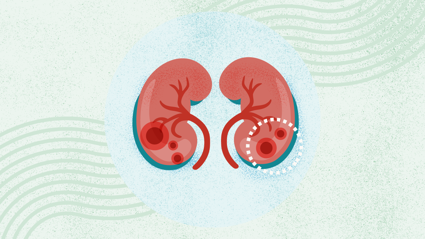 慢性肾病的病理生理机制