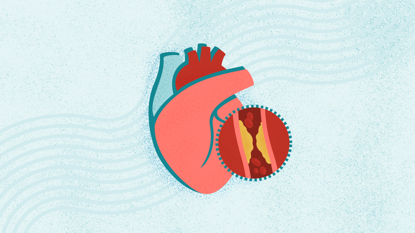 冠心病的早期症状表现有哪些？