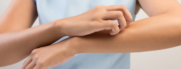 荨麻疹的疾病概述与定义