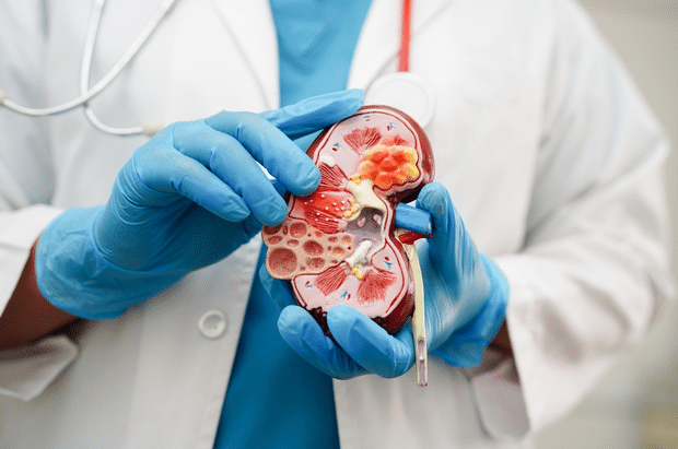 肾结石的病理生理机制