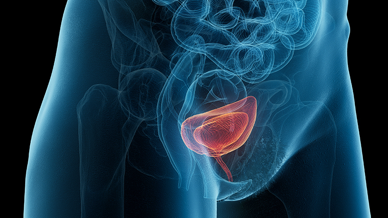 膀胱过度活动症的病理生理机制