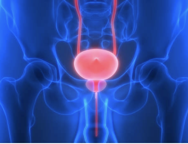 间质性膀胱炎的临床表现与症状