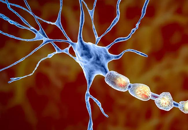 免疫与神经保护：多发性硬化症（MS）的MRI报告解读与疾病修饰药物、疲劳管理