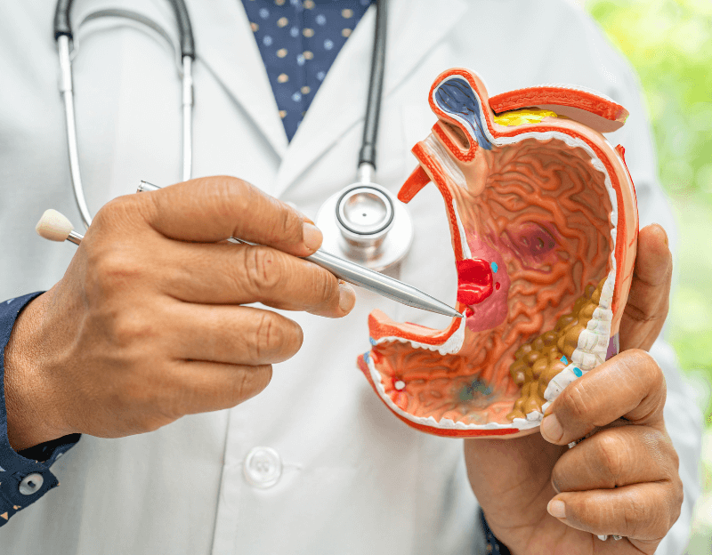 胃癌的营养评估方法