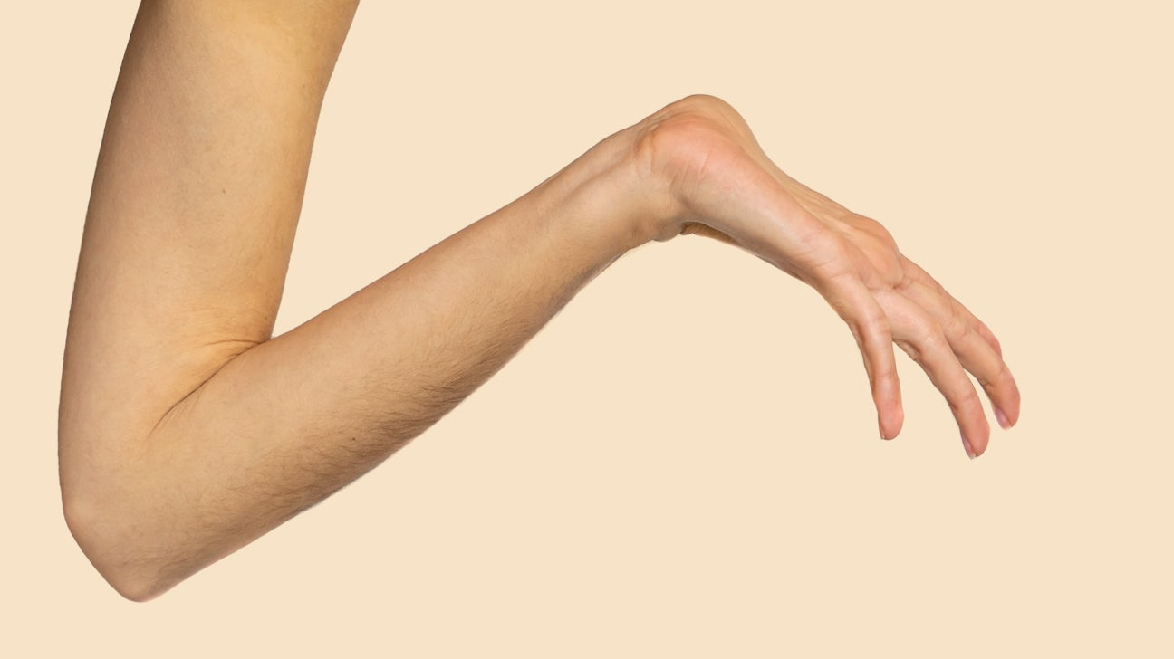 警惕主动脉夹层：马凡综合征的FBN1基因检测、心脏超声报告解读与心血管风险控制